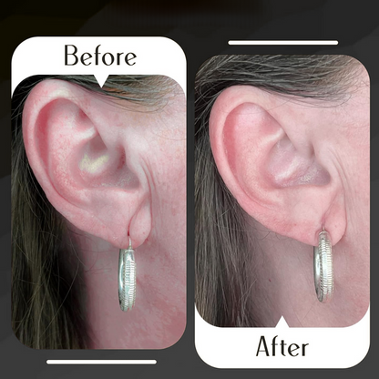 LiftLobe® Invisible Earlobe Support Patches (100 Pcs) – No Sag, No Pain!