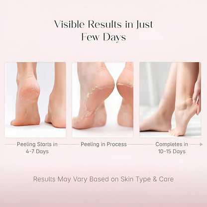 Foot Peeling Mask